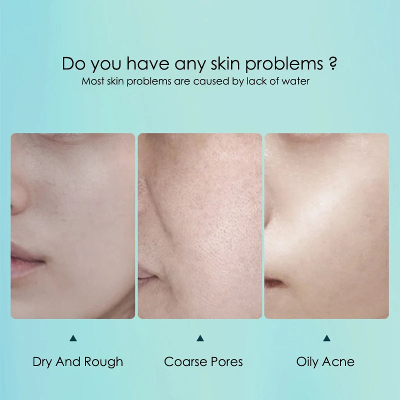 Pore Refining Hyaluronic Mask Set