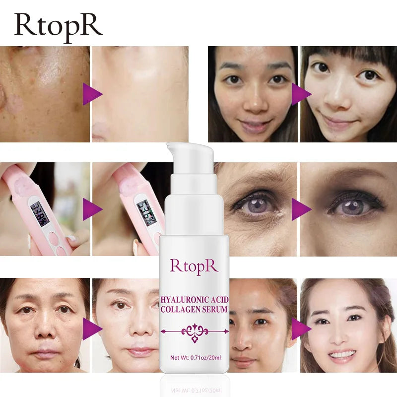 Propolis Acne Clearing Serum