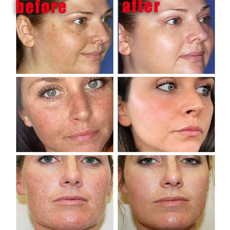 Radiant Skin Brightening Cream