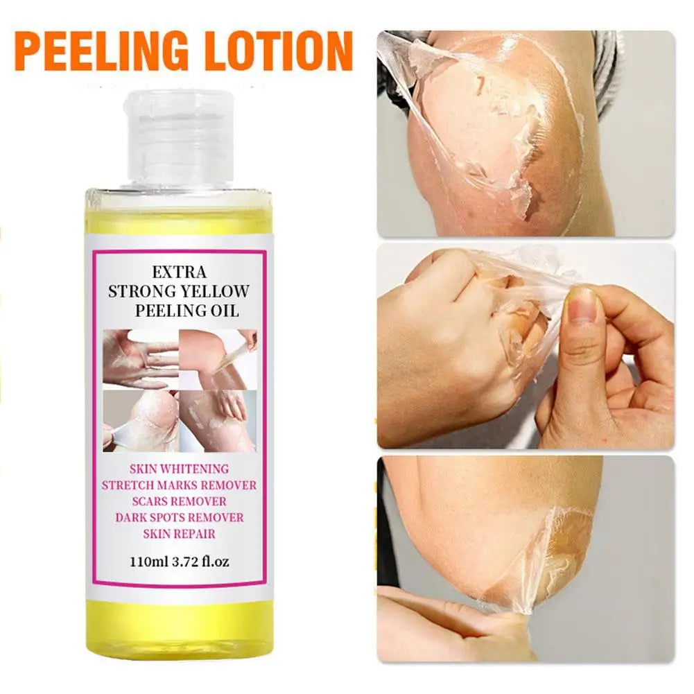 Yellow Peeling Oil