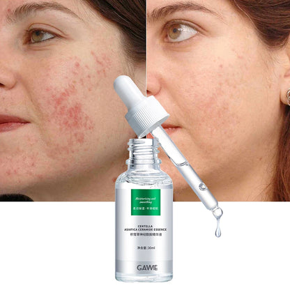 Centella Dark Spot & Acne Serum