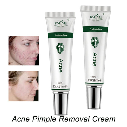 Pimple Remedy Ointment